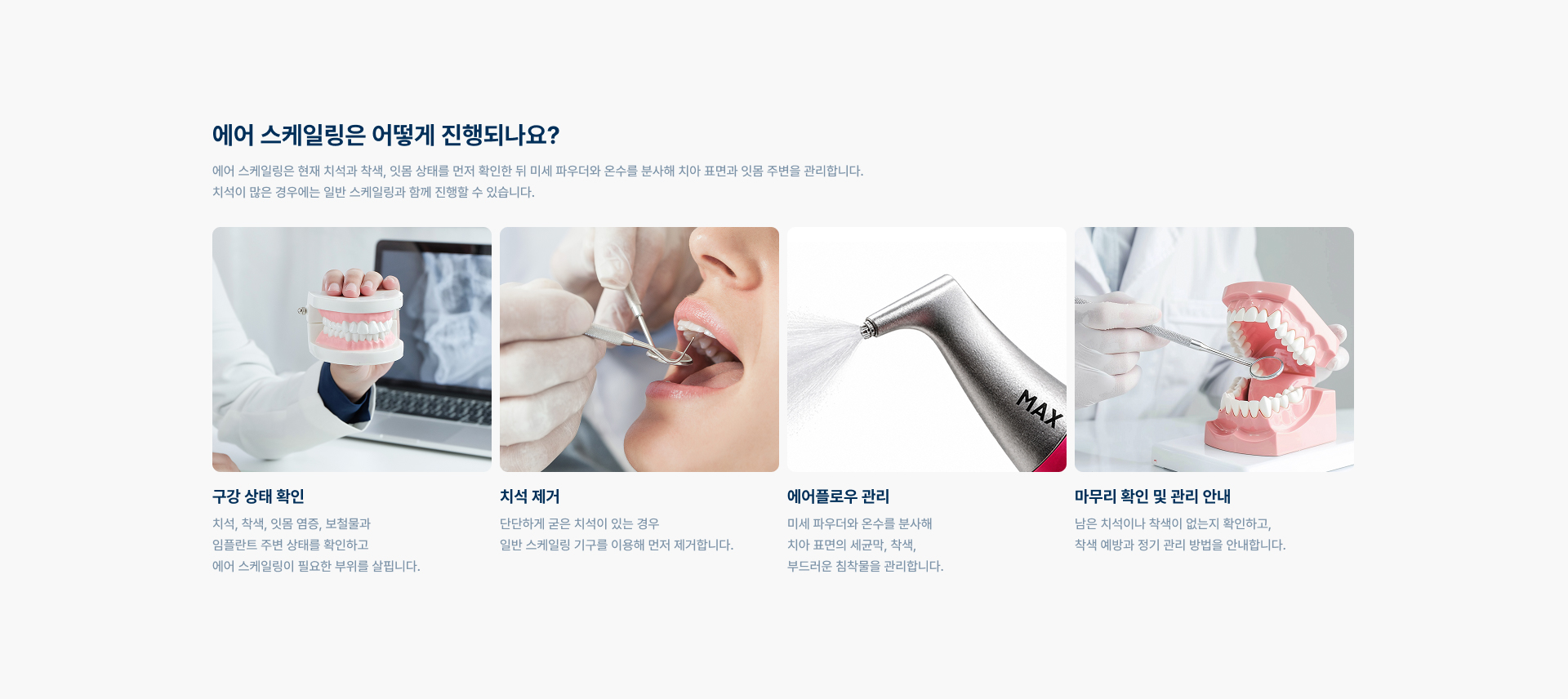 [에어 스케일링은 어떻게 진행되나요?] 구강 상태 확인, 치석 제거, 에어플로우 관리, 마무리 확인 및 관리 안내